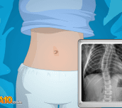 Hra - Operate Now! Scoliosis Surgery